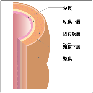 大腸の壁の5層構造のイラスト図